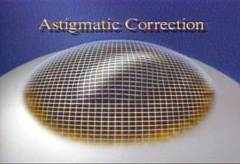 Astigmatism